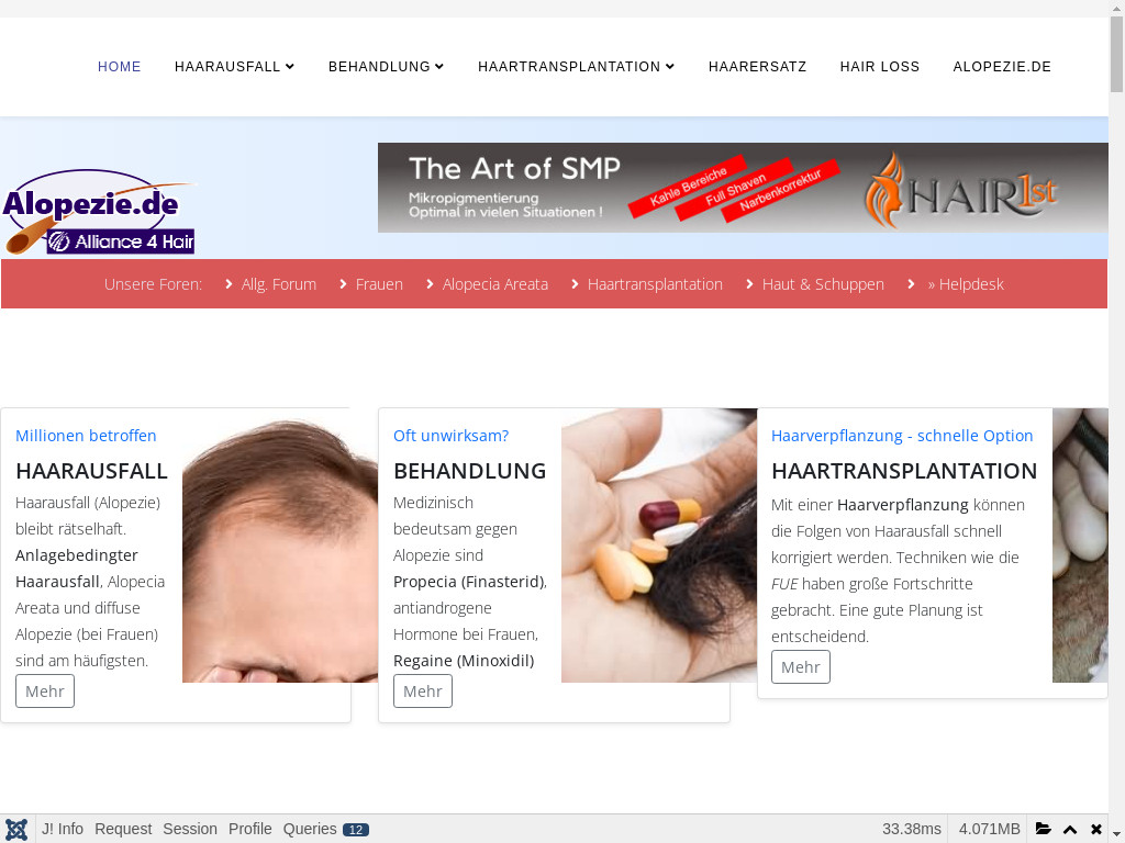 Screenshot of Alopezie.de website
